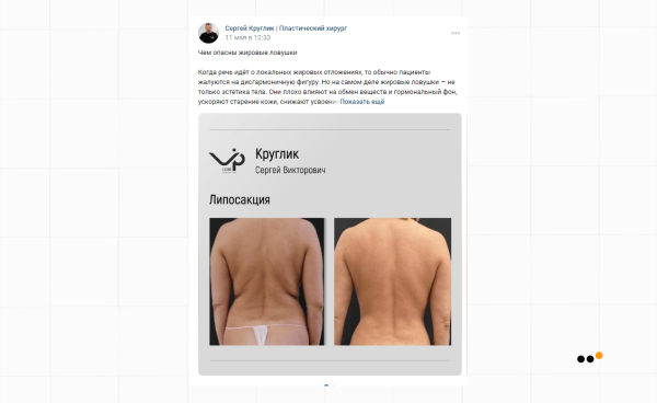 
                    Как выстроить канал продаж ВКонтакте для пластического хирурга, который за 9 месяцев принес более 30 миллионов рублей            