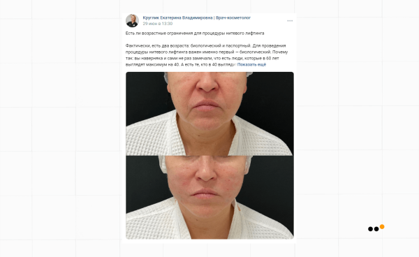 Как мы выстроили систему продаж ВКонтакте и Telegram для врача-косметолога, которая принесла 39+ миллионов рублей             
                    Как мы выстроили систему продаж ВКонтакте и Telegram для врача-косметолога, которая принесла 39+ миллионов рублей