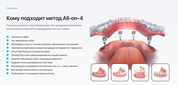 Кейс: Мы вновь начали работать с Игорем по стоматологиям часть 2
Кейс: Мы вновь начали работать с Игорем по стоматологиям часть 2